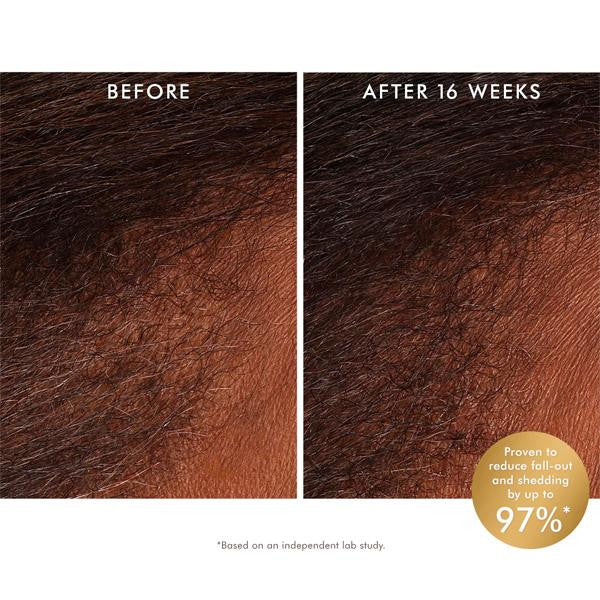 Tonique revitalisant cuir chevelu 100ML | Moroccanoil SCALP | Pour cheveux clairsemés