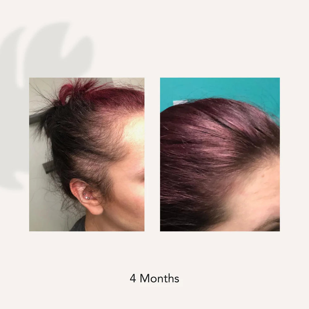 Shampoing Recover Pour Femme 473ML | ACT/IV | Soin capillaire
